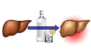 ефектите на алкохола върху черния дроб